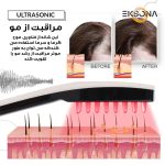 ماساژور برقی سر مدل 003-QC