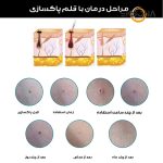 قلم پاک سازی پوست مدل ZM-604