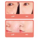 قلم پاک سازی پوست مدل دیجیتالی کد 9 سطح